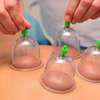 Ensemble de ventouses de massage, 12 Cupping thumb 3