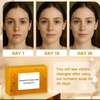 Savon tumeric et kojic acid thumb 3