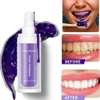 Glory Smile – Blanchiment des dents thumb 0