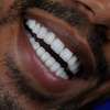 MAUVAISE HALEINE, DENTS SENSIBLES OU PEUR DES CARIES ? thumb 2