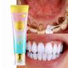 Blanchiment dentaire brite white thumb 1
