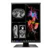 Ecran - moniteur médical pour Radiologie EIZO RX360 3MP thumb 3