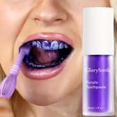 GEL DENTS BLANCHES - Glory Smile