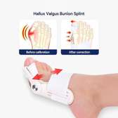 Attelle pour hallux valgus, Correcteur du gros orteil