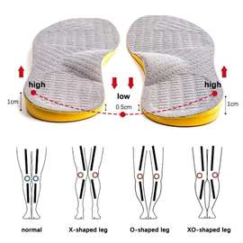 Semelles orthopédiques correction jambes X O XO confort