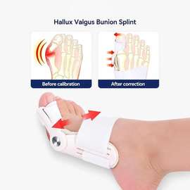 Attelle pour hallux valgus, Correcteur du gros orteil