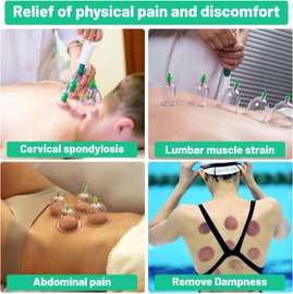 Ensemble de ventouses de massage, 12 Cupping