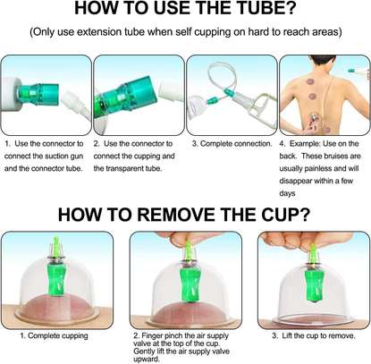 Ventouse Chinoise Biomagnétique, Thérapie image 7