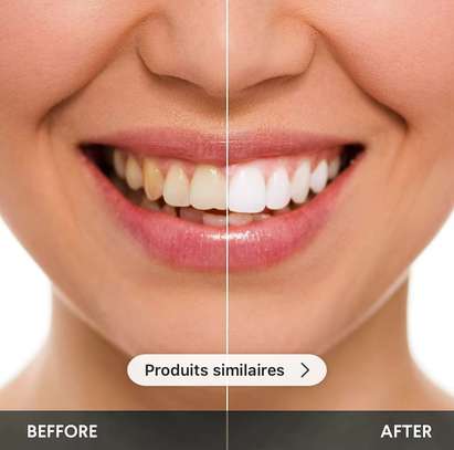 Kit blanchiment des dents LED – Résultat rapide à domicile image 4