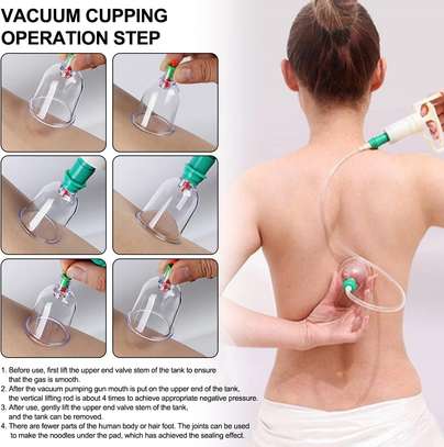 Ventouse Chinoise Biomagnétique, Thérapie image 8