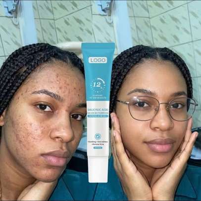Gel anti tâches et acné image 4