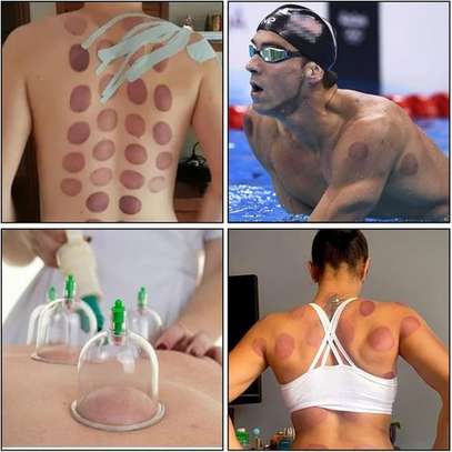 Ensemble de ventouses de massage, 12 Cupping image 9