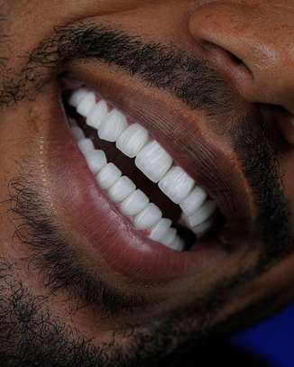 MAUVAISE HALEINE, DENTS SENSIBLES OU PEUR DES CARIES ? image 3