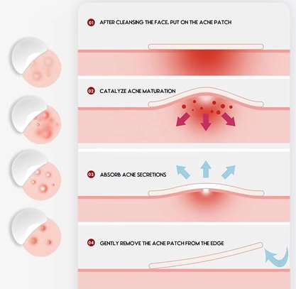 Patch anti-boutons “Miracle Patch” – Résultat rapide ✨ image 2