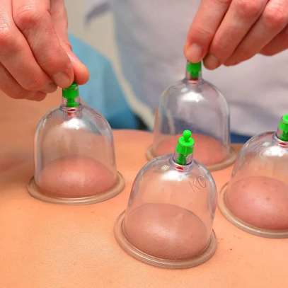 Ensemble de ventouses de massage, 12 Cupping image 4
