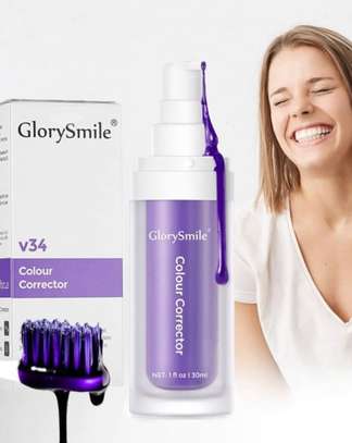Glory Smile – Blanchiment des dents image 2