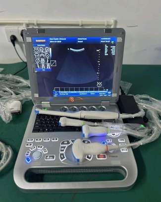 Écho Doppler couleur portable image 1