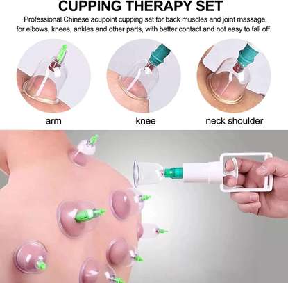 Ventouse Chinoise Biomagnétique, Thérapie image 14