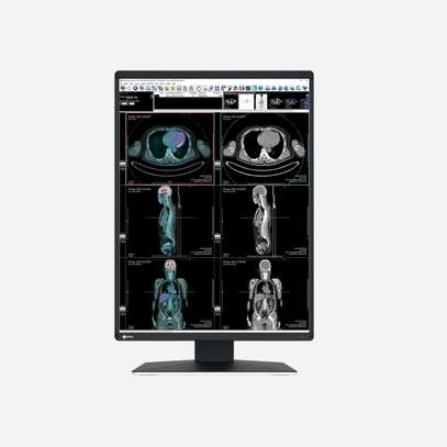 Ecran - moniteur médical pour Radiologie EIZO RX360 3MP image 6