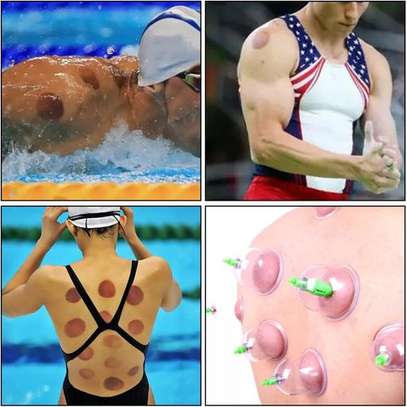 Ensemble de ventouses de massage, 12 Cupping image 12
