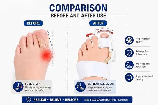 Attelle pour hallux valgus, Correcteur du gros orteil image 15