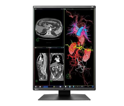 Ecran - moniteur médical pour Radiologie EIZO RX360 3MP image 4