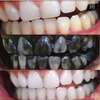 Charcoal Whitening Toothpaste thumb 1