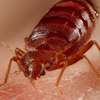 Bed Bug Fumigation and Pest Control Services in Runda/Ruaka thumb 0