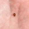 Bed Bug Extermination  Kitisuru, Rosslyn,Thigiri, Lavington thumb 11