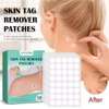 120pc/Skin Tag Removal Patches thumb 5