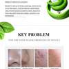Aichun Beauty Kind To Skin Acne Ointment, 30g thumb 1