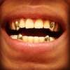 Silverine,,gold tooth caps thumb 1