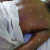 Professional Massage at your comfort kiambu thumb 1