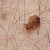 Bed Bug Removal Experts Gachie Runda Nyari Thogoto Rungiri thumb 6