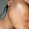 african black soap and raw shea butter thumb 3