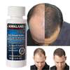 Kirkland Minoxidil For Hair Regrowth Minoxidil 5% thumb 0