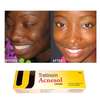 Tretinoin Acnesol Cream Treats Acne & Pimples thumb 1