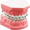 DENTAL BRACKETS LIGATURES O-RINGS FOR SALE IN KENYA thumb 4