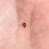 Bed Bug Removal Githunguri/Ruiru/Juja/Thika/Thogoto/Kikuyu thumb 1
