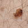 Bed Bug Exterminators | Bed Bug Removal in Nairobi Kenya thumb 9