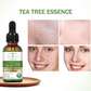 Aichun Beauty Anti-acne, Remove Scar Tea Tree Face Serum