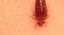 Bedbugs cockroach rats mosquito