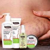 PALMER'S COCOA BUTTER FORMULA*STRETCH MARK REMOVAL LOTION