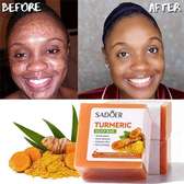 Sadoer Turmeric Soap