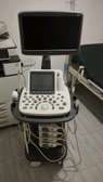 Sonoscope Ultrasound Machine