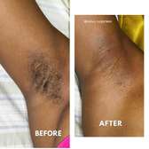 Waxing services for ladies Nairobi