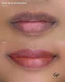 Dark Lip scrub solution