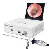 HD PORTABLE ENDOSCOPY UNIT WITH OTOSCOPE ,SINOSCOPE