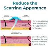 Silicone Scar Removal Gel