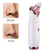 Rechargeable black head remover with 6 heads
